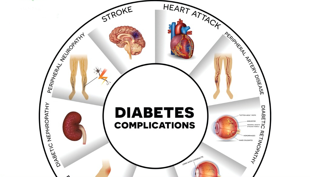 decouvrez-bons-conseils-pour-vous-proteger-des-complications-diabetiques-facilement